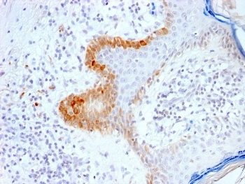Recombinant Cytokeratin 15 Antibody / Rabbit Monoclonal