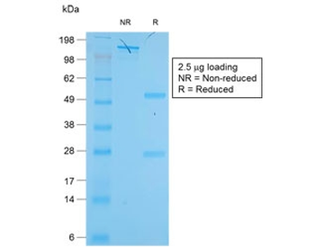Recombinant KRT19 Antibody / Rabbit Monoclonal