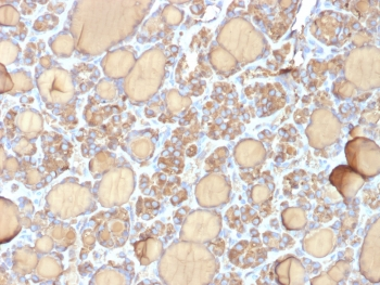 Recombinant TG Antibody / Thyroglobulin