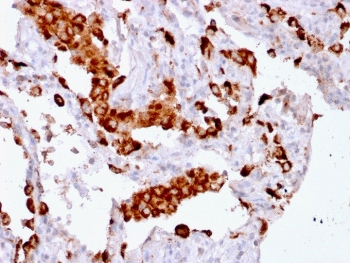 Recombinant Napsin A Antibody