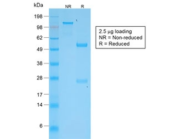 Recombinant TNFSF15 Antibody / TL1A / VEGI