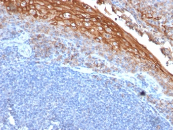 Recombinant CD146 Antibody