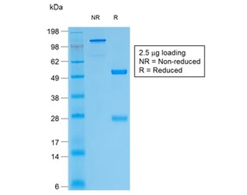 Recombinant Thyroglobulin Antibody / Rabbit Monoclonal