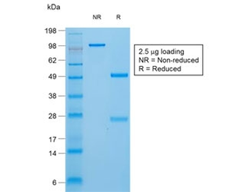 Recombinant TG Antibody / Rabbit Monoclonal