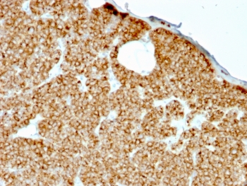Recombinant Parathyroid Hormone Antibody / N-Terminal