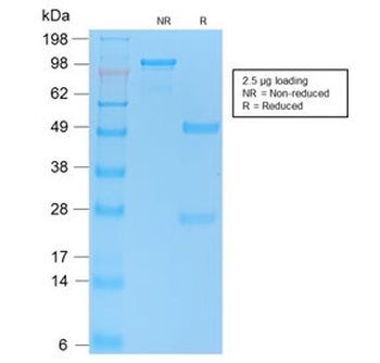 Recombinant p53 Antibody / Rabbit Monoclonal