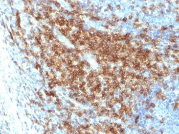 Recombinant CD43 Antibody / Rabbit Monoclonal