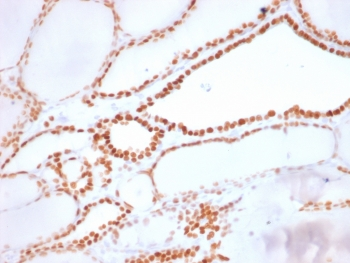 Recombinant NKX2.1 Antibody / TTF-1 Rabbit Monoclonal