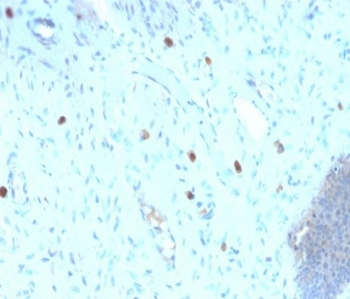 Recombinant HPV16 L1 Antibody / Rabbit Monoclonal