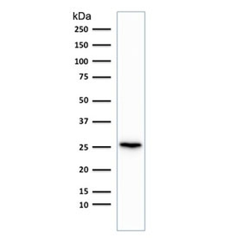 Recombinant PGP9.5 Antibody