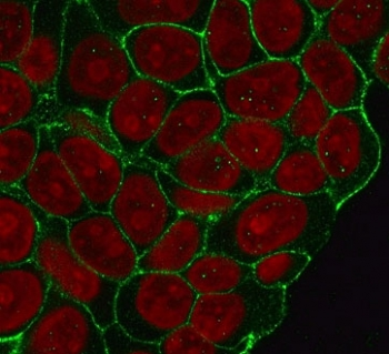 Recombinant Beta Catenin Antibody / Rabbit Monoclonal