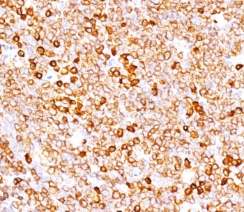 Recombinant CD79a Antibody / Rabbit Monoclonal