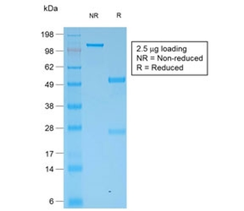 Recombinant Multi Cytokeratin Antibody / Rabbit Monoclonal