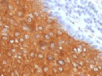 Recombinant Cytokeratin 10 Antibody / Rabbit Monoclonal