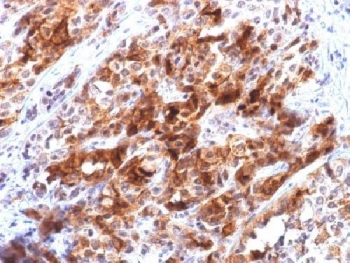 Recombinant GPC3 Antibody / Glypican-3