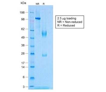 Recombinant TNFa Antibody / Rabbit Monoclonal
