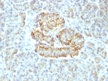 Recombinant TNFa Antibody / Rabbit Monoclonal