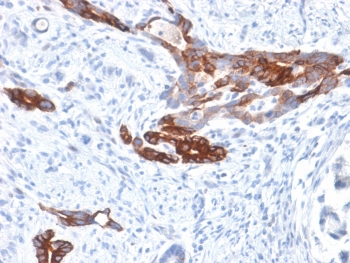 Recombinant Gastric Mucin Antibody / MUC6 / Rabbit Monoclonal