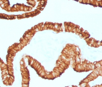 Recombinant Cytokeratin 7 Antibody / Rabbit Monoclonal