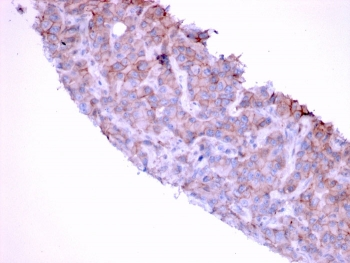EGF Receptor Antibody