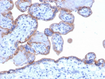 EGF Receptor Antibody
