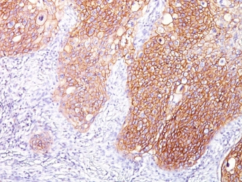 EGF Receptor Antibody