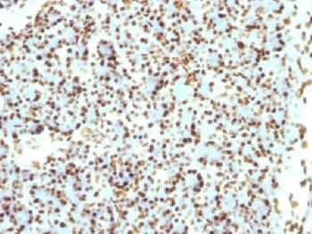 Recombinant Histone H1 Antibody