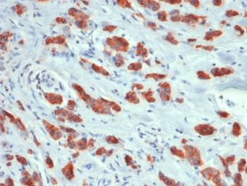 Recombinant Mucin-1 Antibody / Rabbit Monoclonal