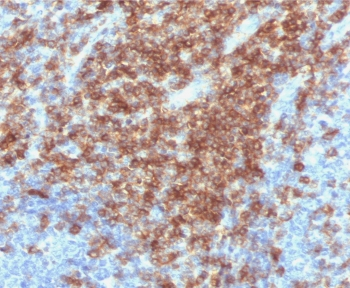 Recombinant CD43 Antibody / Rabbit Monoclonal