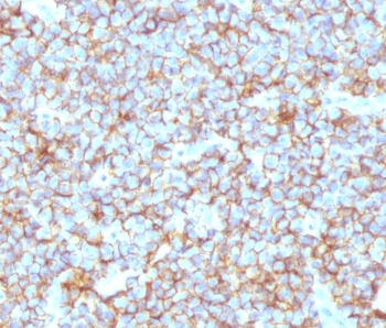 Recombinant CD99 Antibody / Rabbit Monoclonal