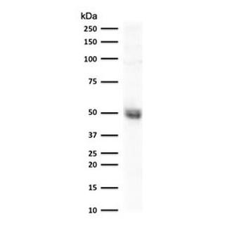 CD14 Antibody (Macrophage Marker)