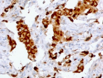Recombinant Napsin A Antibody / Rabbit Monoclonal