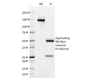 AKT1 Antibody