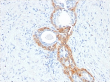 Recombinant Basic Cytokeratin Antibody