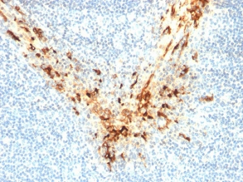 Mesothelin Antibody / MSLN
