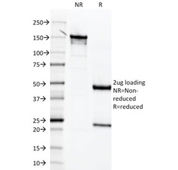 Mesothelin Antibody / MSLN