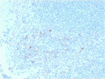 CD25 Antibody