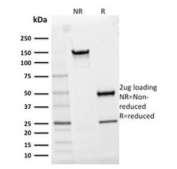CD25 Antibody