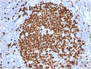 Ki-67 Antibody
