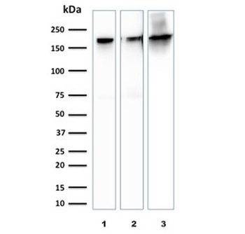 Spectrin beta III Antibody / SPTBN2