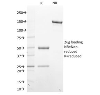 STAT6 Antibody
