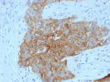 GLUT1 Antibody