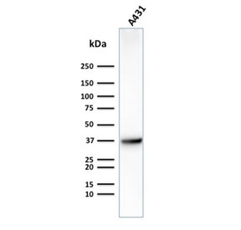 GLUT1 Antibody