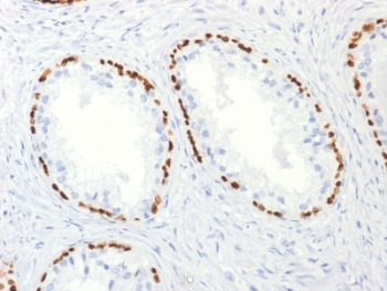 p63 Antibody