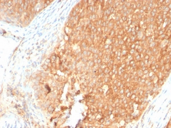 Recombinant TOP1MT Antibody