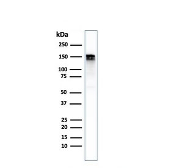 Recombinant EGF Receptor Antibody