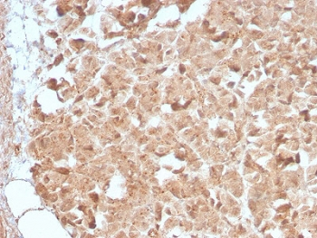Recombinant CELA3B Antibody / Elastase 3B