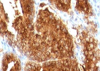 AMACR Antibody