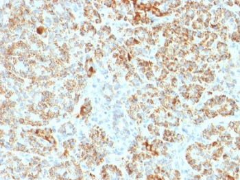 FXN Antibody / Frataxin