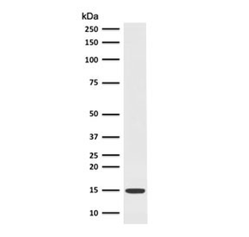 Frataxin Antibody / FXN